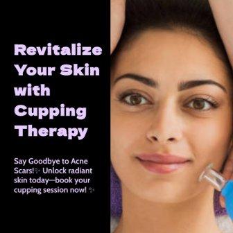 Enhance Your Natural Beauty with Cupping Therapy